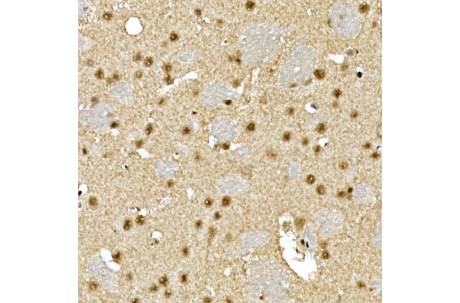 Immunohistochemistry - Anti-Visfatin Antibody (A12579) - Antibodies.com