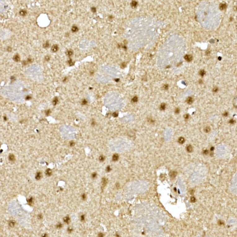 Immunohistochemistry - Anti-Visfatin Antibody (A12579) - Antibodies.com