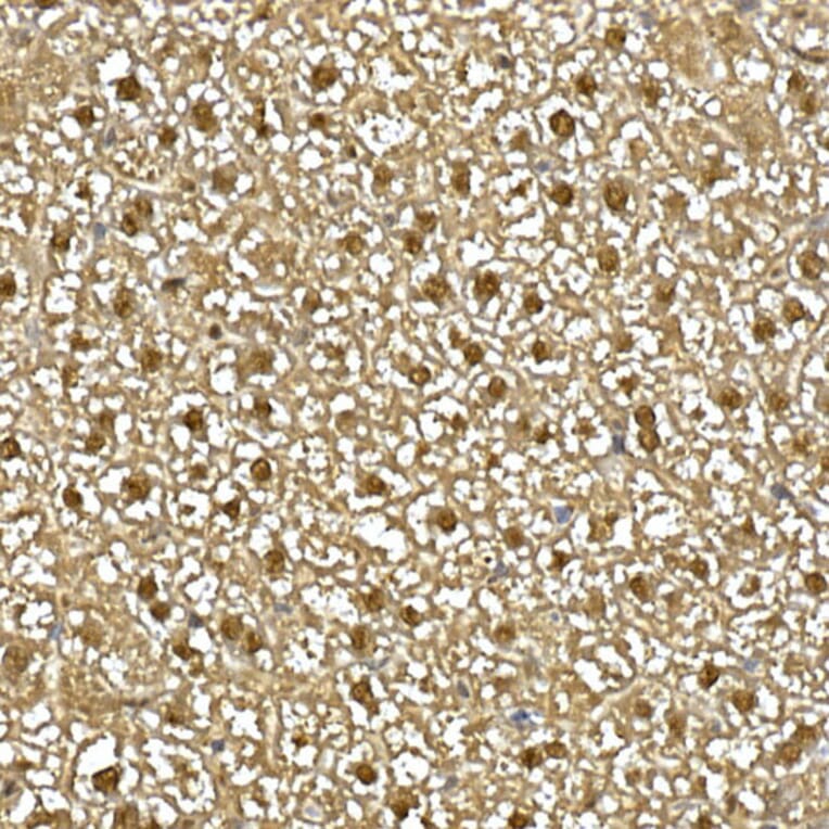 Immunohistochemistry - Anti-Visfatin Antibody (A12579) - Antibodies.com