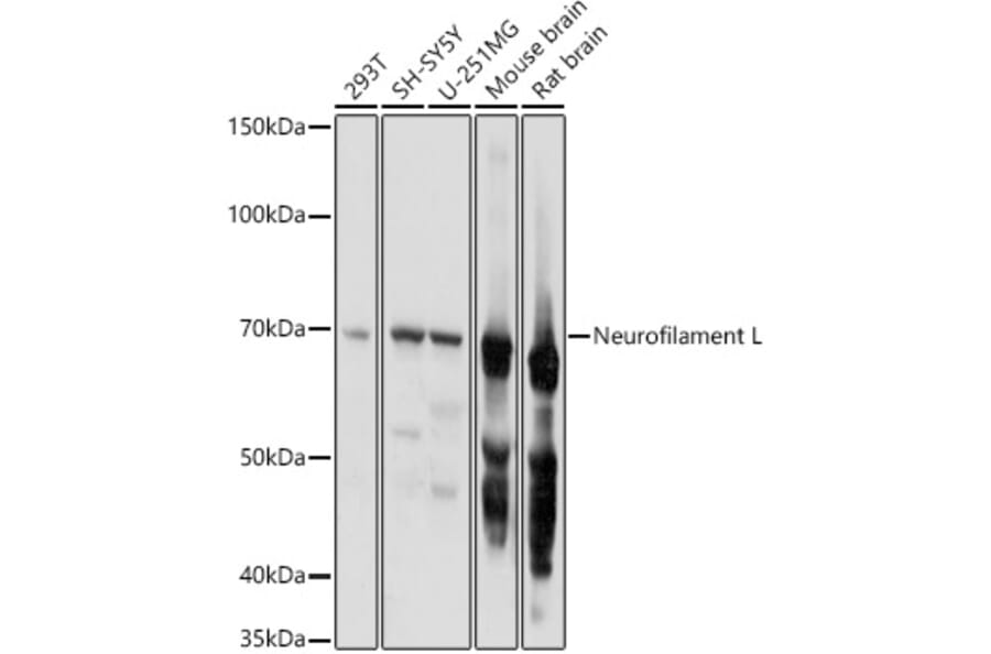 Western Blot - Anti-68kDa Neurofilament/NF-L Antibody (A12580) - Antibodies.com