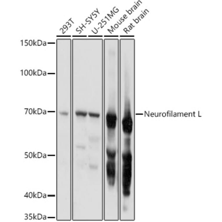 Western Blot - Anti-68kDa Neurofilament/NF-L Antibody (A12580) - Antibodies.com