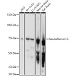Western Blot - Anti-68kDa Neurofilament/NF-L Antibody (A12580) - Antibodies.com