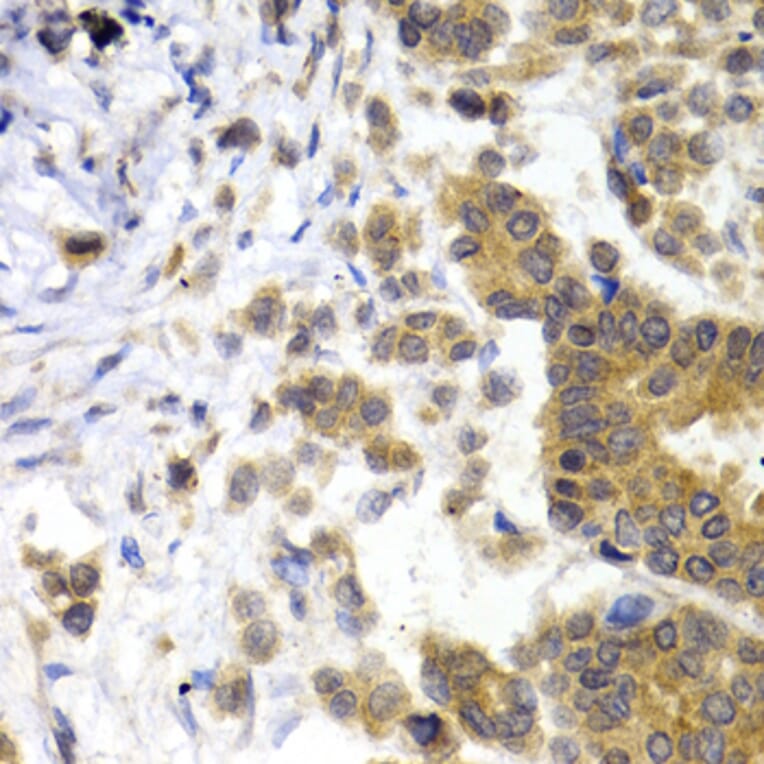 Immunohistochemistry - Anti-68kDa Neurofilament/NF-L Antibody (A12580) - Antibodies.com