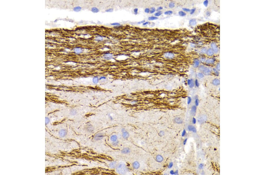 Immunohistochemistry - Anti-68kDa Neurofilament/NF-L Antibody (A12580) - Antibodies.com