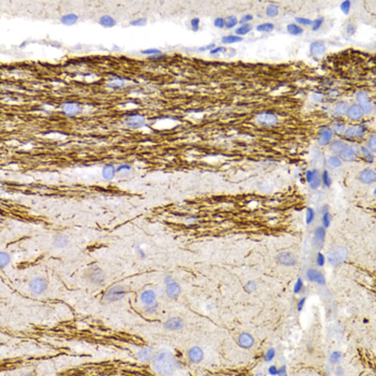 Immunohistochemistry - Anti-68kDa Neurofilament/NF-L Antibody (A12580) - Antibodies.com