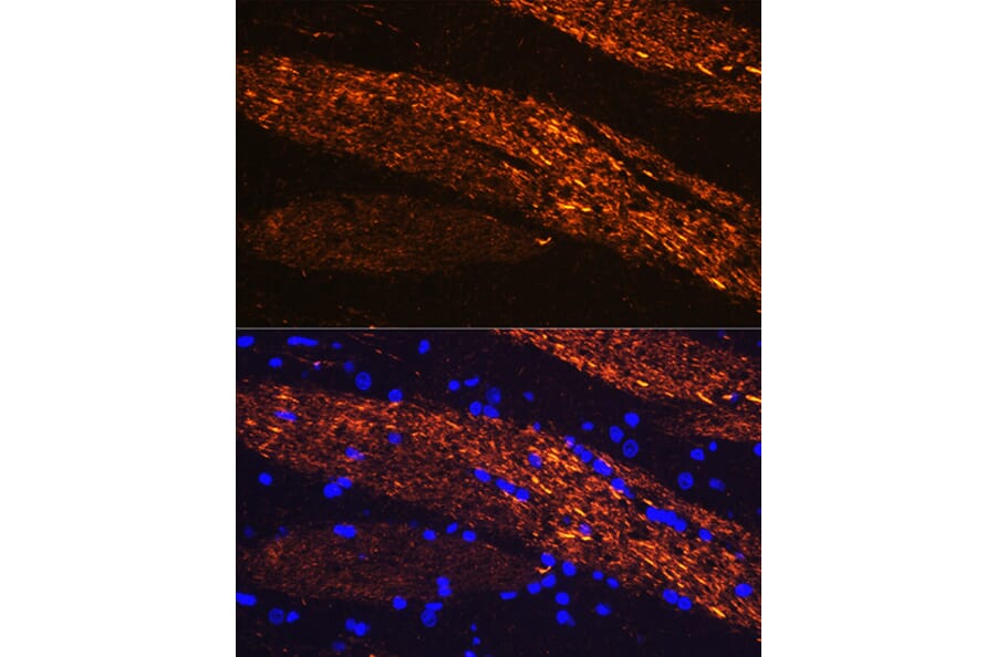 Immunofluorescence - Anti-68kDa Neurofilament/NF-L Antibody (A12580) - Antibodies.com