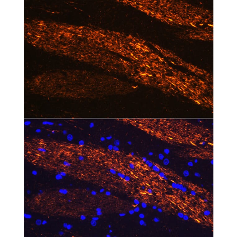 Immunofluorescence - Anti-68kDa Neurofilament/NF-L Antibody (A12580) - Antibodies.com