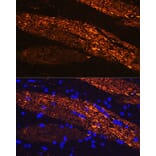 Immunofluorescence - Anti-68kDa Neurofilament/NF-L Antibody (A12580) - Antibodies.com