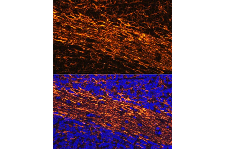 Immunofluorescence - Anti-68kDa Neurofilament/NF-L Antibody (A12580) - Antibodies.com