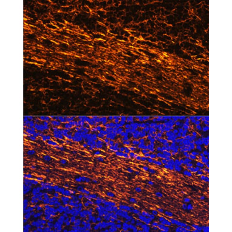 Immunofluorescence - Anti-68kDa Neurofilament/NF-L Antibody (A12580) - Antibodies.com