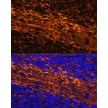 Immunofluorescence - Anti-68kDa Neurofilament/NF-L Antibody (A12580) - Antibodies.com
