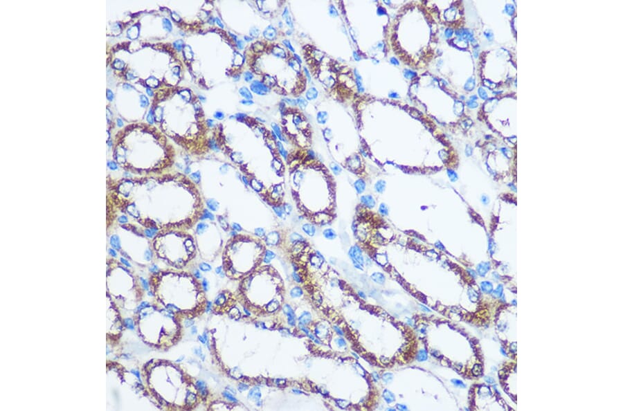 Immunohistochemistry - Anti-NM23A Antibody (A12581) - Antibodies.com