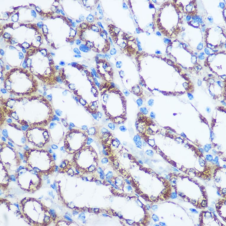 Immunohistochemistry - Anti-NM23A Antibody (A12581) - Antibodies.com