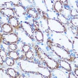 Immunohistochemistry - Anti-NM23A Antibody (A12581) - Antibodies.com