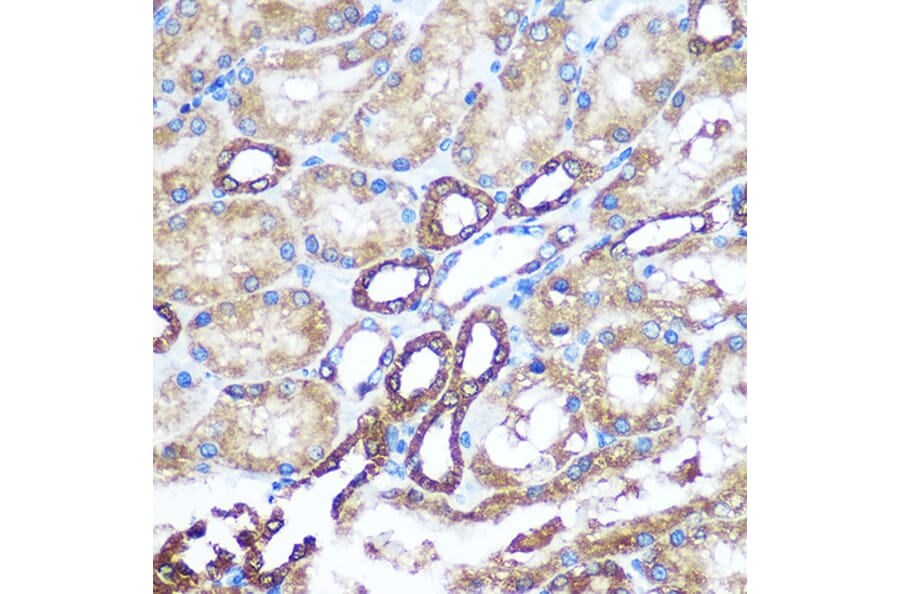Immunohistochemistry - Anti-NM23A Antibody (A12581) - Antibodies.com