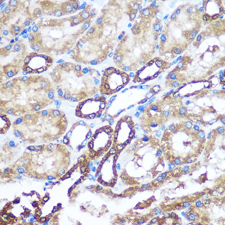 Immunohistochemistry - Anti-NM23A Antibody (A12581) - Antibodies.com
