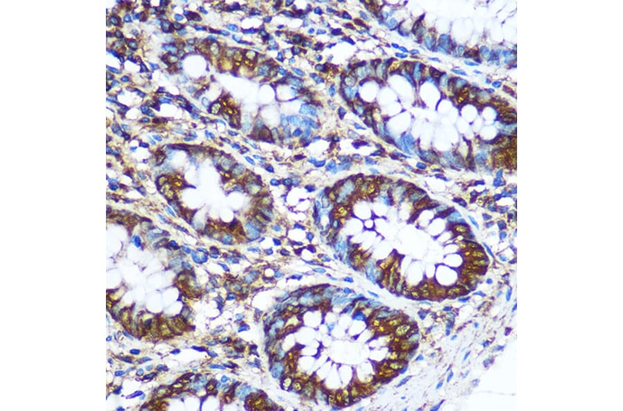 Immunohistochemistry - Anti-NM23A Antibody (A12581) - Antibodies.com