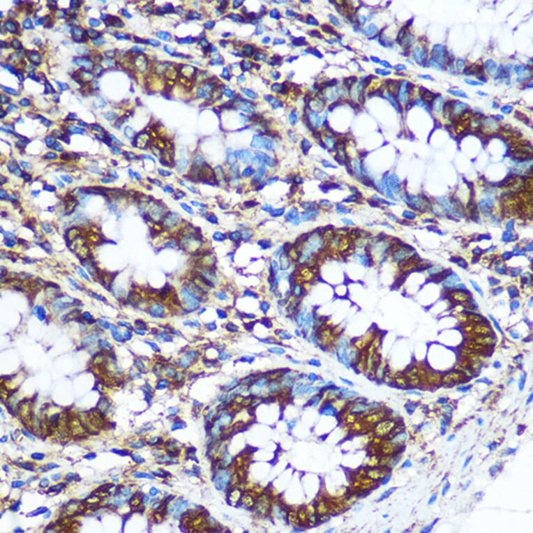 Immunohistochemistry - Anti-NM23A Antibody (A12581) - Antibodies.com