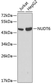 Western blot analysis of extracts of various cell lines, using Anti-NUDT6 Antibody (A0260) at 1:1,000 dilution.
Secondary antibody: Goat Anti-Rabbit IgG (H+L) (HRP) (AS014) at 1:10,000 dilution.
Lysates / proteins: 25µg per lane.
Blocking buffer: 3% non-fat dry milk in TBST.