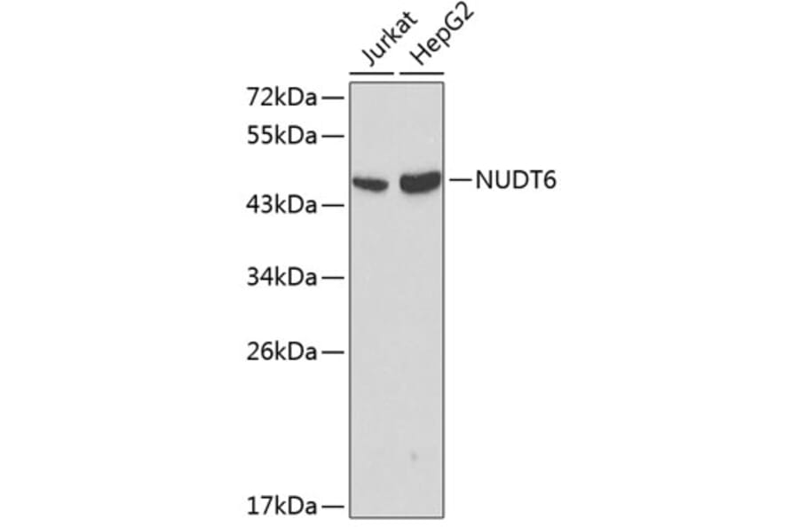 Western Blot - Anti-NUDT6 Antibody (A0260) - Antibodies.com