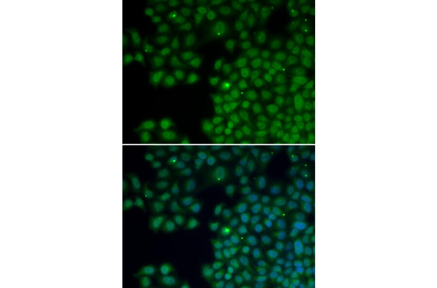 Immunofluorescence - Anti-NUDT6 Antibody (A0260) - Antibodies.com