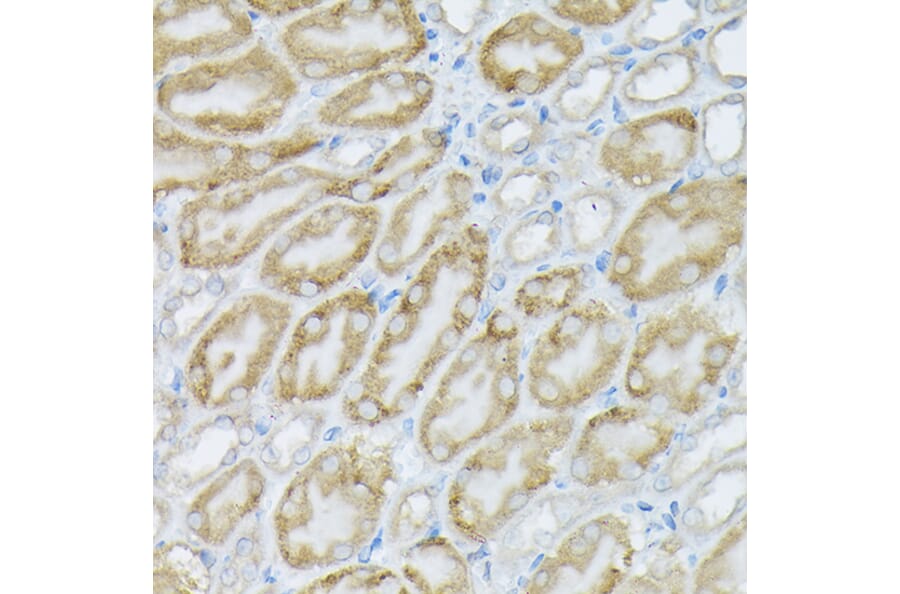 Immunohistochemistry - Anti-PI 3 Kinase catalytic subunit alpha/PIK3CA Antibody (A12585) - Antibodies.com