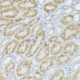 Immunohistochemistry - Anti-PI 3 Kinase catalytic subunit alpha/PIK3CA Antibody (A12585) - Antibodies.com