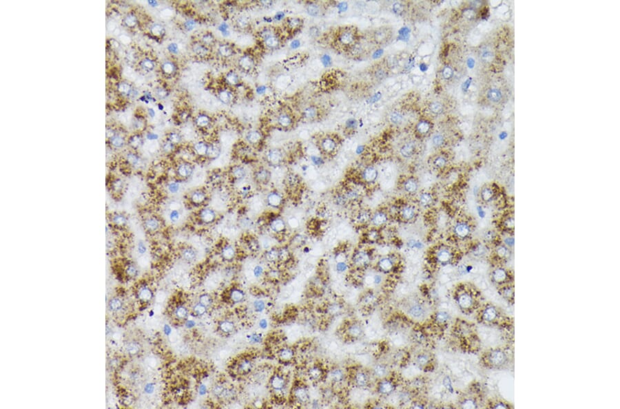 Immunohistochemistry - Anti-PI 3 Kinase catalytic subunit alpha/PIK3CA Antibody (A12585) - Antibodies.com