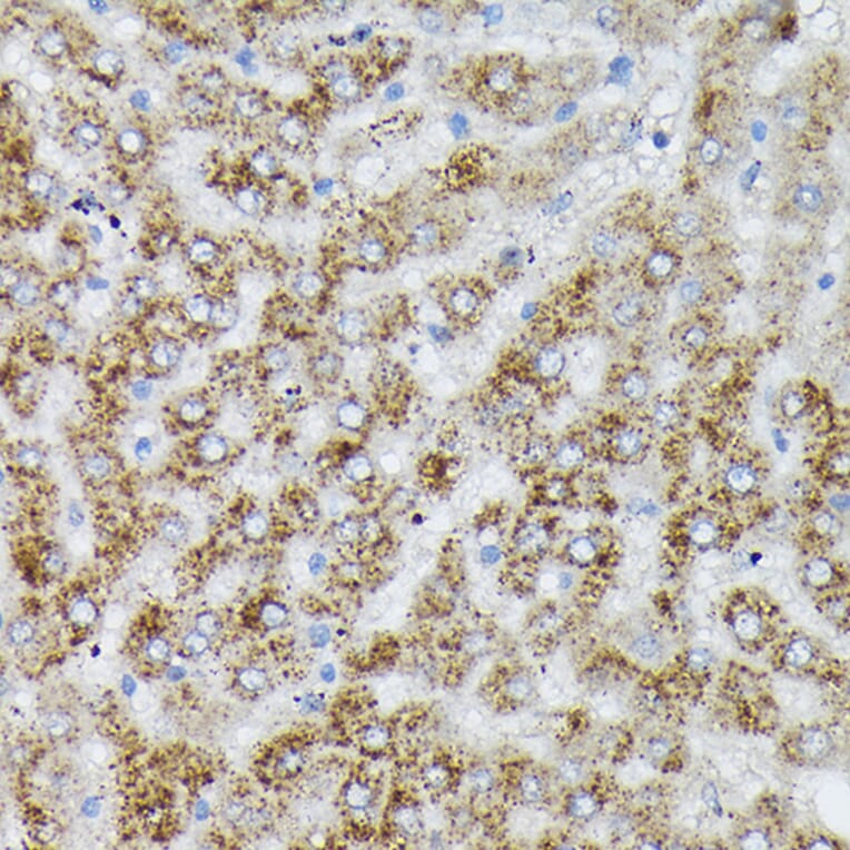 Immunohistochemistry - Anti-PI 3 Kinase catalytic subunit alpha/PIK3CA Antibody (A12585) - Antibodies.com