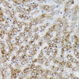 Immunohistochemistry - Anti-PI 3 Kinase catalytic subunit alpha/PIK3CA Antibody (A12585) - Antibodies.com