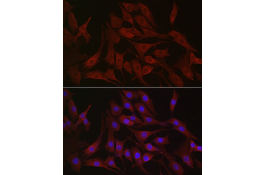 Immunofluorescence - Anti-PI 3 Kinase catalytic subunit alpha/PIK3CA Antibody (A12585) - Antibodies.com