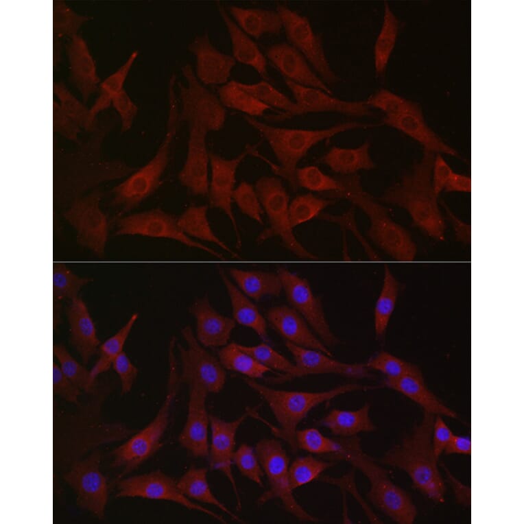 Immunofluorescence - Anti-PI 3 Kinase catalytic subunit alpha/PIK3CA Antibody (A12585) - Antibodies.com