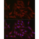 Immunofluorescence - Anti-PI 3 Kinase catalytic subunit alpha/PIK3CA Antibody (A12585) - Antibodies.com