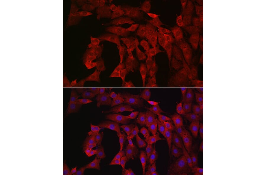 Immunofluorescence - Anti-PI 3 Kinase catalytic subunit alpha/PIK3CA Antibody (A12585) - Antibodies.com