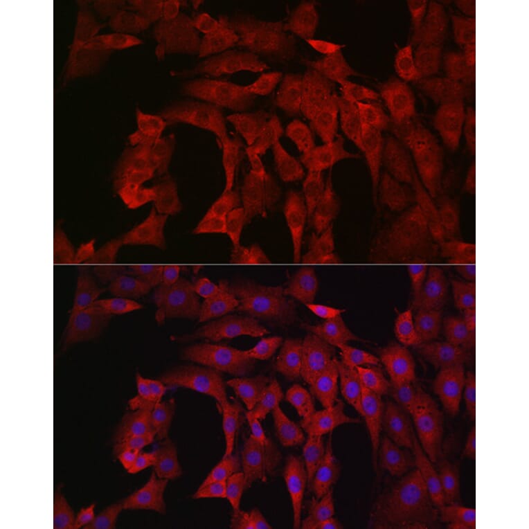 Immunofluorescence - Anti-PI 3 Kinase catalytic subunit alpha/PIK3CA Antibody (A12585) - Antibodies.com
