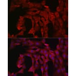 Immunofluorescence - Anti-PI 3 Kinase catalytic subunit alpha/PIK3CA Antibody (A12585) - Antibodies.com