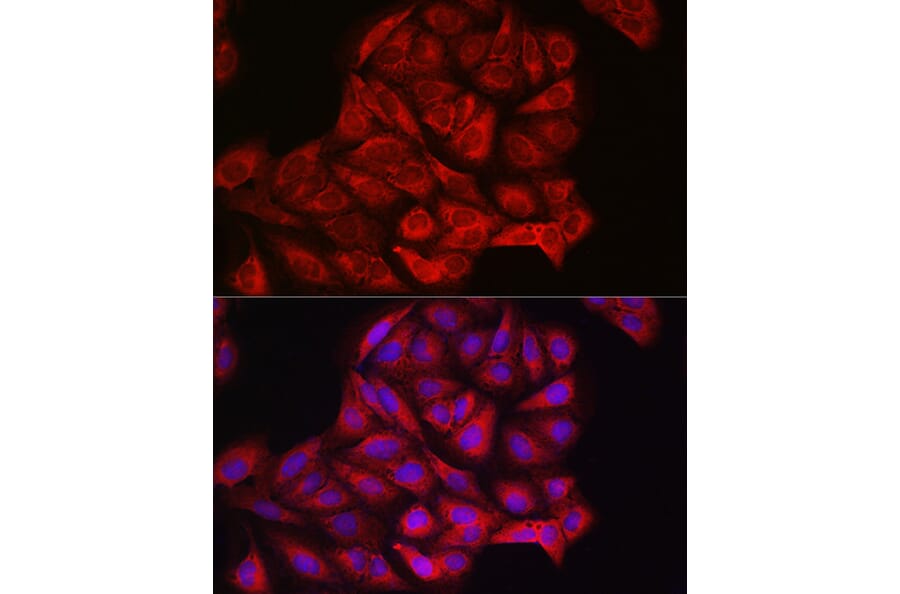 Immunofluorescence - Anti-PI 3 Kinase catalytic subunit alpha/PIK3CA Antibody (A12585) - Antibodies.com