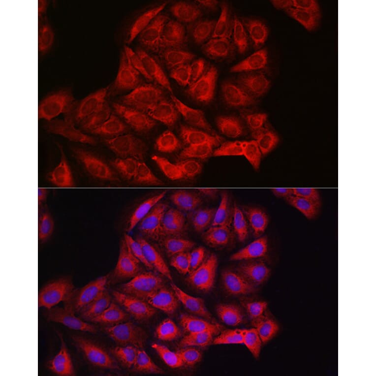 Immunofluorescence - Anti-PI 3 Kinase catalytic subunit alpha/PIK3CA Antibody (A12585) - Antibodies.com