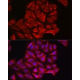 Immunofluorescence - Anti-PI 3 Kinase catalytic subunit alpha/PIK3CA Antibody (A12585) - Antibodies.com
