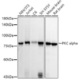 Western Blot - Anti-PKC alpha Antibody (A12587) - Antibodies.com