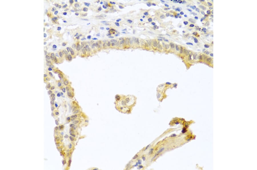 Immunohistochemistry - Anti-PKC alpha Antibody (A12587) - Antibodies.com