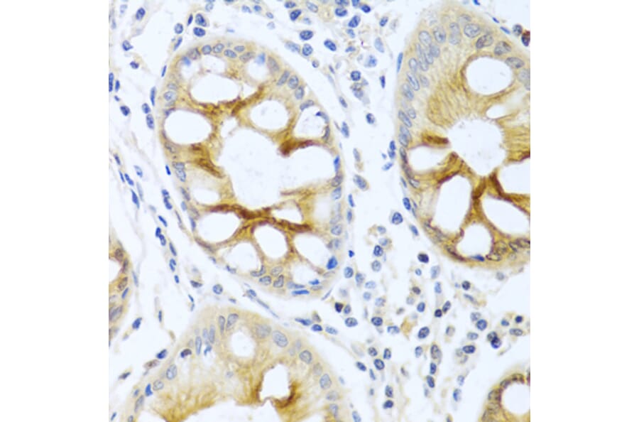 Immunohistochemistry - Anti-PKC alpha Antibody (A12587) - Antibodies.com