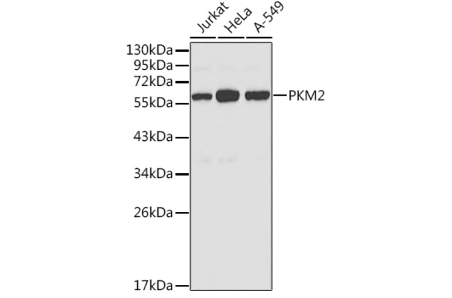 Western Blot - Anti-PKM2 Antibody (A12588) - Antibodies.com