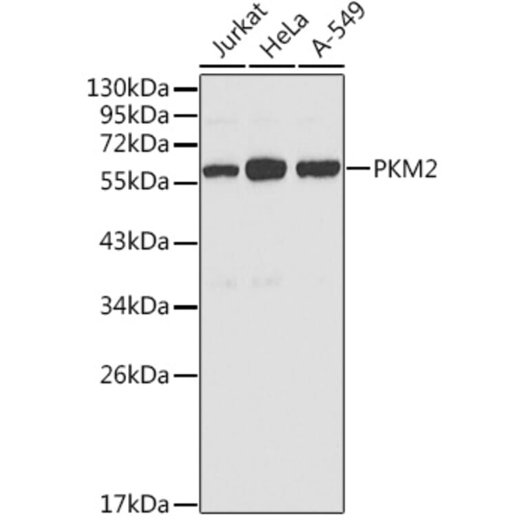 Western Blot - Anti-PKM2 Antibody (A12588) - Antibodies.com