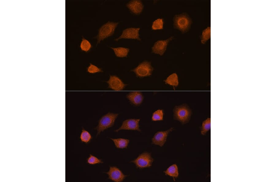 Immunofluorescence - Anti-PKM2 Antibody (A12588) - Antibodies.com