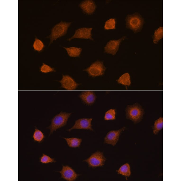 Immunofluorescence - Anti-PKM2 Antibody (A12588) - Antibodies.com