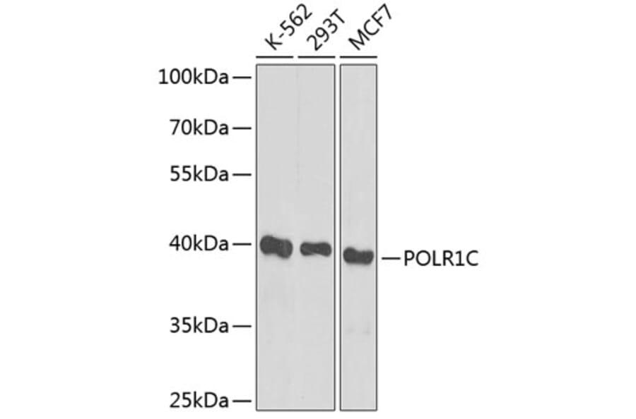 Western Blot - Anti-POLR1C Antibody (A12589) - Antibodies.com