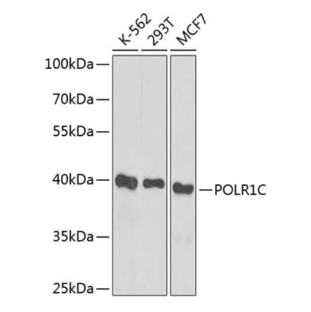 Western Blot - Anti-POLR1C Antibody (A12589) - Antibodies.com