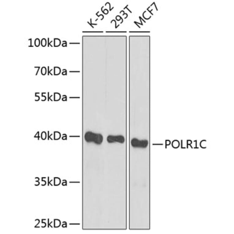 Western Blot - Anti-POLR1C Antibody (A12589) - Antibodies.com