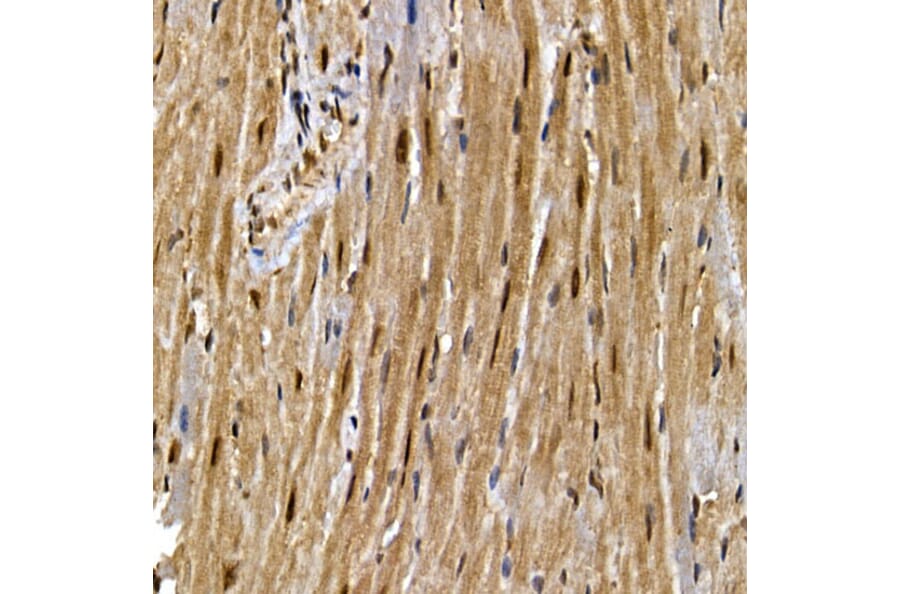Immunohistochemistry - Anti-PPAR gamma Antibody (A12590) - Antibodies.com